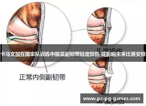 卡马文加在国家队训练中膝盖副韧带轻度扭伤 或影响未来比赛安排